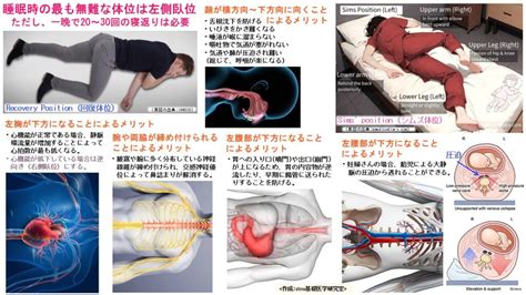 左側位|睡眠時の最も無難な体位は左側臥位 